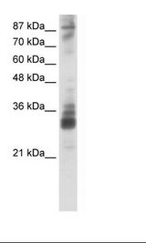 HepG2 Cell Lysate