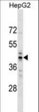 RG9MTD2 Antibody western blot of HepG2 cell line lysates (35 ug/lane). The RG9MTD2 antibody detected the RG9MTD2 protein (arrow).