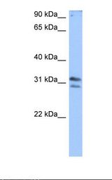 Jurkat cell lysate. Antibody concentration: 0.5 ug/ml. Gel concentration: 12%.