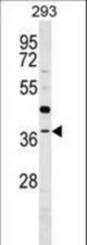 RG9MTD3 Antibody western blot of 293 cell line lysates (35 ug/lane). The RG9MTD3 antibody detected the RG9MTD3 protein (arrow).