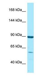RGL1 / RGL antibody Western Blot of Fetal Heart.