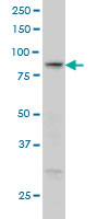 RGL1 monoclonal antibody (M01), clone 2D10 Western blot of RGL1 expression in A-431.