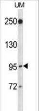 RGL2 Antibody western blot of uterine tumor cell line lysates (35 ug/lane). The RGL2 antibody detected the RGL2 protein (arrow).