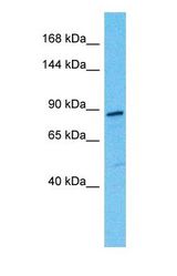 Western blot of SE6L2 Antibody with human Fetal Kidney lysate.