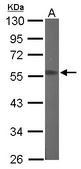 Sample (50 ug of whole cell lysate). A: Mouse brain. 10% SDS PAGE. RGMB antibody diluted at 1:1000.
