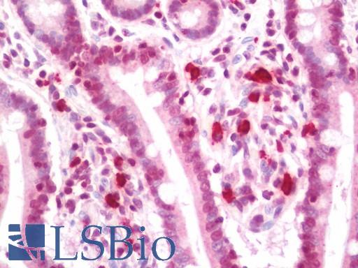 Anti-PSK / SEZ6L2 antibody IHC staining of human small intestine. Immunohistochemistry of formalin-fixed, paraffin-embedded tissue after heat-induced antigen retrieval. Antibody LS-B11391 dilution 1:100.