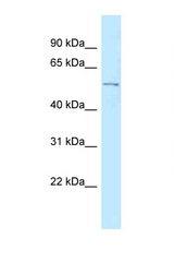 RGMB antibody LS-C145889 Western blot of HCT15 Cell lysate. Antibody concentration 1 ug/ml.