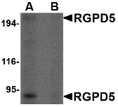 Western blot of RGPD5 in EL4 cell lysate with RGPD5 antibody at 1 ug/ml in (A) the absence and (B) the presence of blocking peptide.