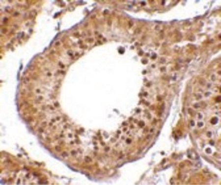 Immunohistochemistry of RGPD5 in human testis tissue cells with RGPD5 antibody at 10 ug/ml.