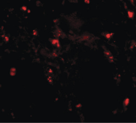 Immunofluorescence of RGPD5 in human testis tissue with RGPD5 antibody at 20 ug/ml.