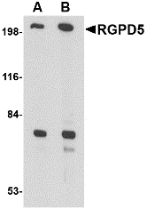 Western blot of RGPD5 in EL4 cell lysate with RGPD5 antibody at (A) 1 and (B) 2 ug/ml.