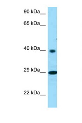 RGR antibody LS-C146481 Western blot of PANC1 Cell lysate. Antibody concentration 1 ug/ml.