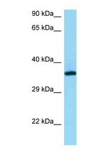 RGR antibody LS-C146482 Western blot of PANC1 Cell lysate. Antibody concentration 1 ug/ml.