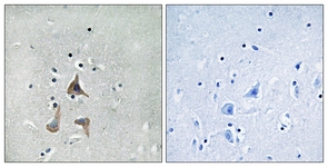 IHC of paraffin-embedded human brain tissue, using RGR Antibody. The sample on the right was incubated with synthetic peptide.