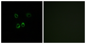Immunofluorescence of MCF7 cells, using RGR Antibody. The sample on the right was incubated with synthetic peptide.