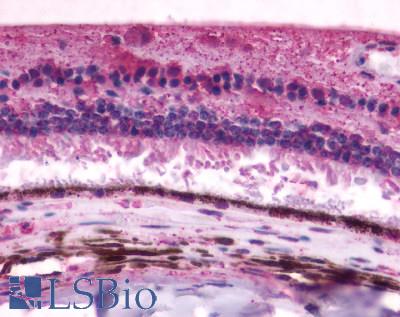 Anti-RGR antibody LS-A1044 IHC of human eye, retina. Immunohistochemistry of formalin-fixed, paraffin-embedded tissue after heat-induced antigen retrieval.