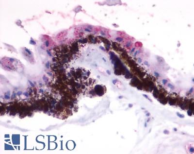 Anti-RGR antibody LS-A1043 IHC of human eye, pigmented epithelium within the retina. Immunohistochemistry of formalin-fixed, paraffin-embedded tissue after heat-induced antigen retrieval.