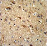 RGR Antibody IHC of formalin-fixed and paraffin-embedded brain tissue followed by peroxidase-conjugated secondary antibody and DAB staining.
