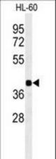 Western blot of RGR Antibody in HL-60 cell line lysates (35 ug/lane). RGR (arrow) was detected using the purified antibody.