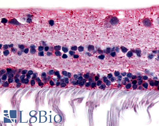 Anti-RGR antibody LS-A1042 IHC of human retina. Immunohistochemistry of formalin-fixed, paraffin-embedded tissue after heat-induced antigen retrieval.
