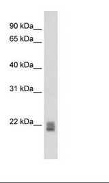 SP2/0 Cell Lysate