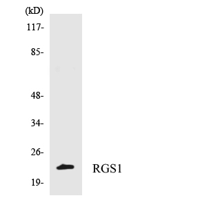 Western blot of the lysates from 293 cells using RGS1 antibody.
