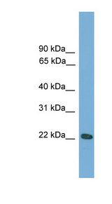 RGS1 antibody LS-C117099 Western blot of Mouse Uterus lysate.