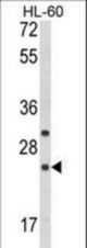 Western blot of RGS1 Antibody in HL-60 cell line lysates (35 ug/lane). RGS1 (arrow) was detected using the purified antibody.