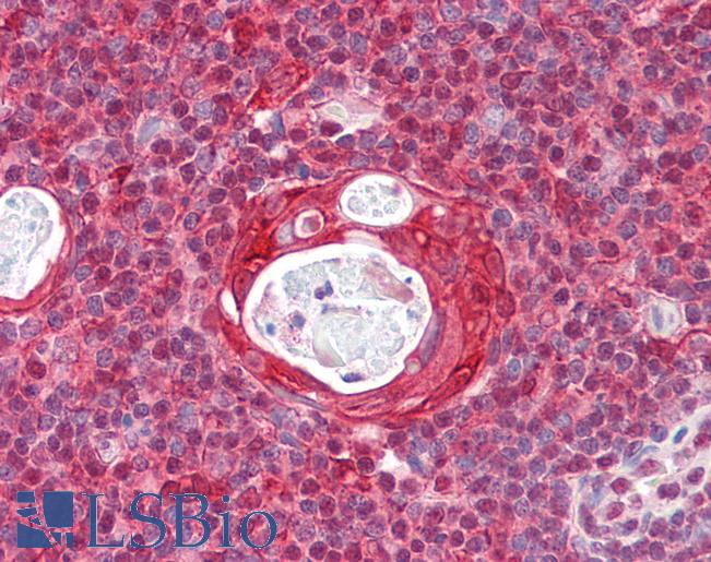 Anti-RGS1 antibody IHC of human thymus. Immunohistochemistry of formalin-fixed, paraffin-embedded tissue after heat-induced antigen retrieval. Antibody LS-B7701 dilution 10 ug/ml.
