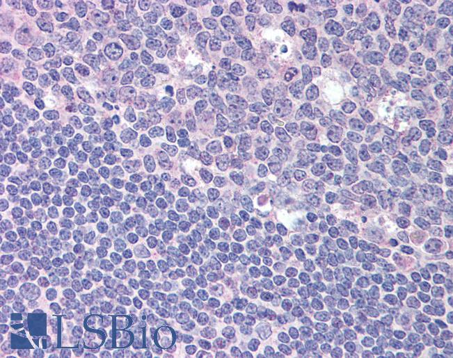 Anti-RGS1 antibody IHC of human tonsil. Immunohistochemistry of formalin-fixed, paraffin-embedded tissue after heat-induced antigen retrieval. Antibody LS-B1984 concentration 20 ug/ml.