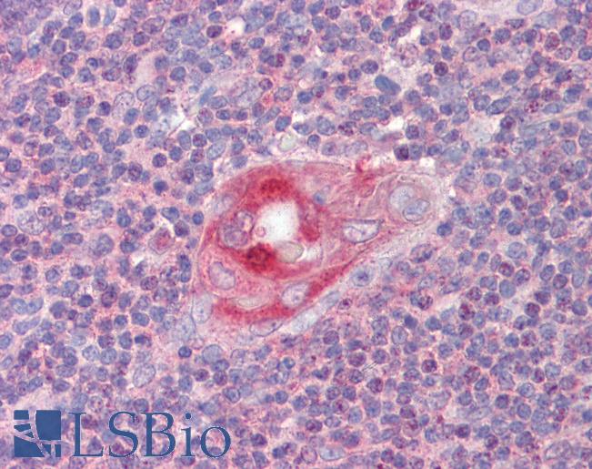Anti-RGS1 antibody IHC of human thymus. Immunohistochemistry of formalin-fixed, paraffin-embedded tissue after heat-induced antigen retrieval. Antibody LS-B3594 concentration 2.5 ug/ml.