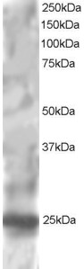 Antibody staining (1 ug/ml) of HepG2 lysate (RIPA buffer, 30 ug total protein per lane). Primary incubated for 1 hour. Detected by Western blot of chemiluminescence.