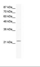 Jurkat Cell Lysate