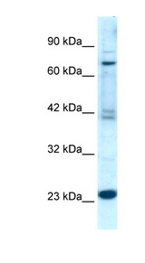 RGS10 antibody LS-B996 Western blot of Jurkat lysate.