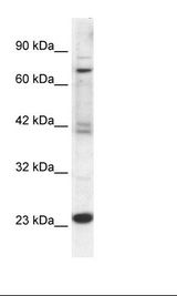 Jurkat Cell Lysate
