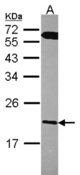 Sample (30 ug of whole cell lysate). A: A431 . 12% SDS PAGE. RGS10 antibody diluted at 1:1000.