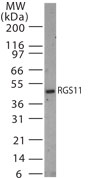 Western blot of RGS11 in 30 ugs of rat brain tissue lysate using antibody at 1:1000 dilution.