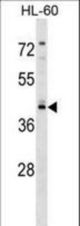 RGS11 Antibody western blot of HL-60 cell line lysates (35 ug/lane). The RGS11 antibody detected the RGS11 protein (arrow).