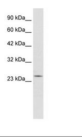 Daudi Cell Lysate