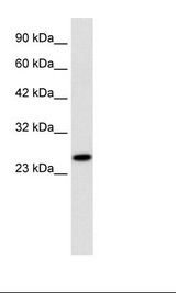 Daudi Cell Lysate