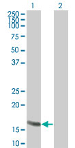 Western blot ofRGS13 in 1) transfected 293T cells and 2) untransfected 293T cells using LS-C148189 at 1:500.