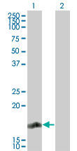 Western blot ofRGS13 in 1) transfected 293T cells and 2) untransfected 293T cells using LS-C148187 at 1:500.