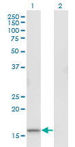 Western blot of RGS13 expression in transfected 293T cell line by RGS13 monoclonal antibody (M06), clone 1B3.