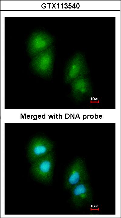 Immunofluorescence of paraformaldehyde-fixed A549 using RGS13 antibody at 1:200 dilution.
