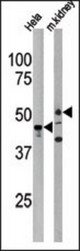 Western blot of anti-PSKH1 Antibody (N-term H70) in HeLa cell line lysate and mouse kidney tissue lysate (35 ug/lane). PSKH1 (arrow) was detected using the purified antibody.