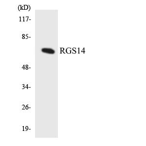 Western blot of the lysates from HUVEC cells using RGS14 antibody.