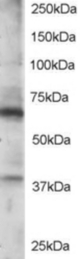 Antibody staining (0.5 ug/ml) of Jurkat lysate (RIPA buffer, 35 ug total protein per lane). Primary incubated for 1 hour. Detected by Western blot of chemiluminescence.