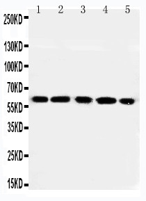 WB of RGS14 antibody. Lane 1: Rat Thymus Tissue Lysate. Lane 2: Rat Spleen Tissue Lysate. Lane 3: RAJI Cell Lysate. Lane 4: CEM Cell Lysate. Lane 5: JURKAT Cell Lysate.