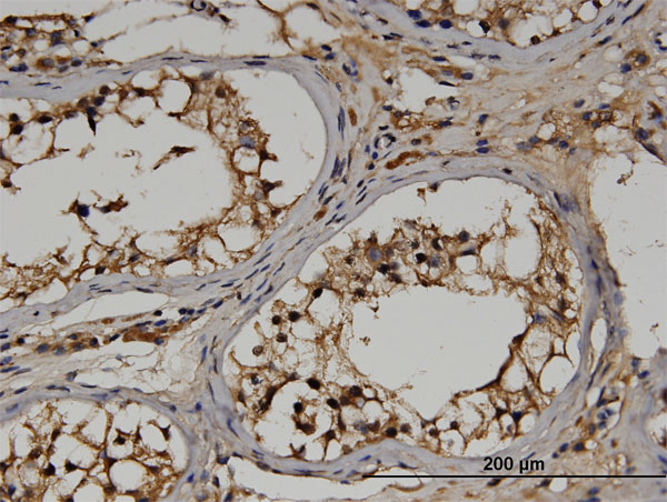 Immunoperoxidase of monoclonal antibody to RGS14 on formalin-fixed paraffin-embedded human testis. [antibody concentration 3 ug/ml]