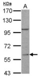 RGS14 antibody [C3], C-term detects RGS14 protein by Western blot analysis. A. 30 ug Jurkat whole lysate/extract. 7.5 % SDS-PAGE. RGS14 antibody [C3], C-term dilution:1:500